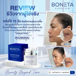 boneta โบเนต้า ครีมบำรุงผิว ลดฝ้า กระ จุดด่างดำ ริ้วรอย กระชับรูบขุมขน ทัตถการ ศัลยกรรม โบท็อก นวดหน้า