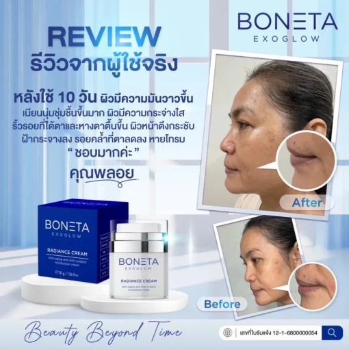 boneta โบเนต้า ครีมบำรุงผิว ลดฝ้า กระ จุดด่างดำ ริ้วรอย กระชับรูบขุมขน ทัตถการ ศัลยกรรม โบท็อก นวดหน้า