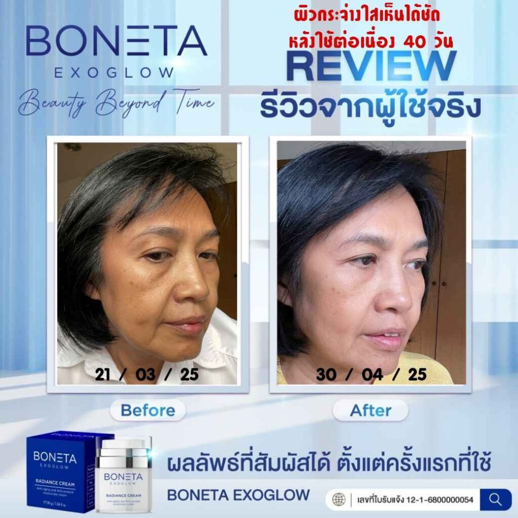 boneta โบเนต้า ครีมบำรุงผิว ลดฝ้า กระ จุดด่างดำ ริ้วรอย กระชับรูบขุมขน ทัตถการ ศัลยกรรม โบท็อก นวดหน้า