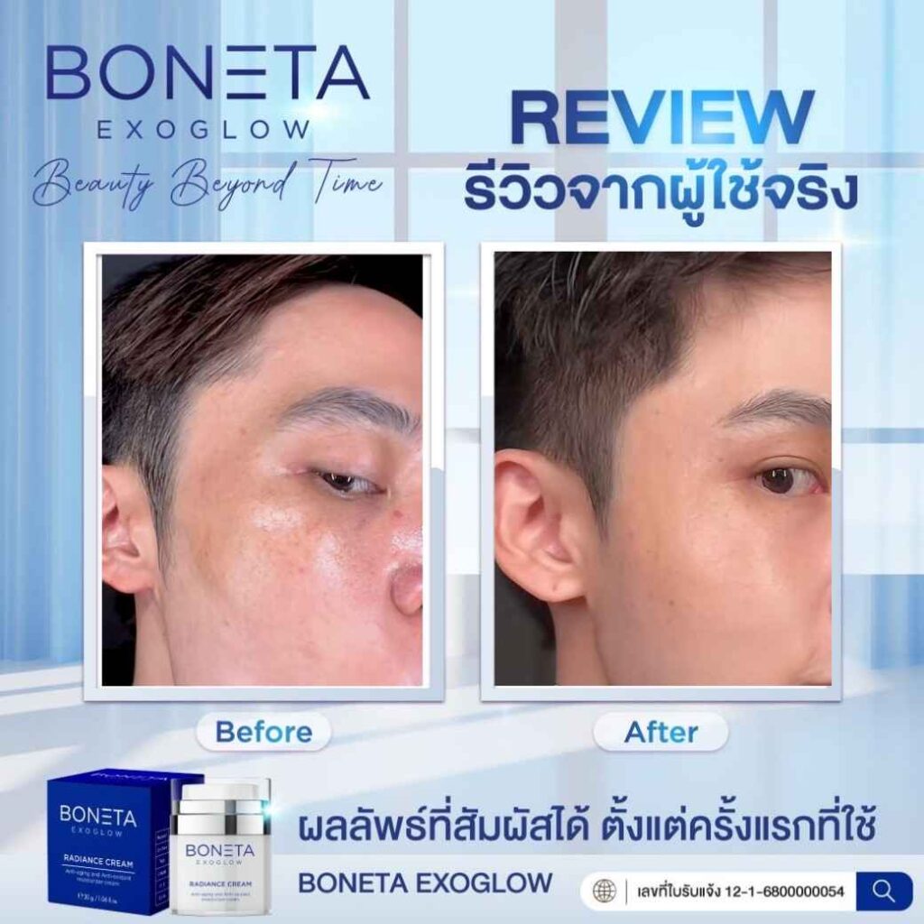 boneta โบเนต้า ครีมบำรุงผิว ลดฝ้า กระ จุดด่างดำ ริ้วรอย กระชับรูบขุมขน ทัตถการ ศัลยกรรม โบท็อก นวดหน้า